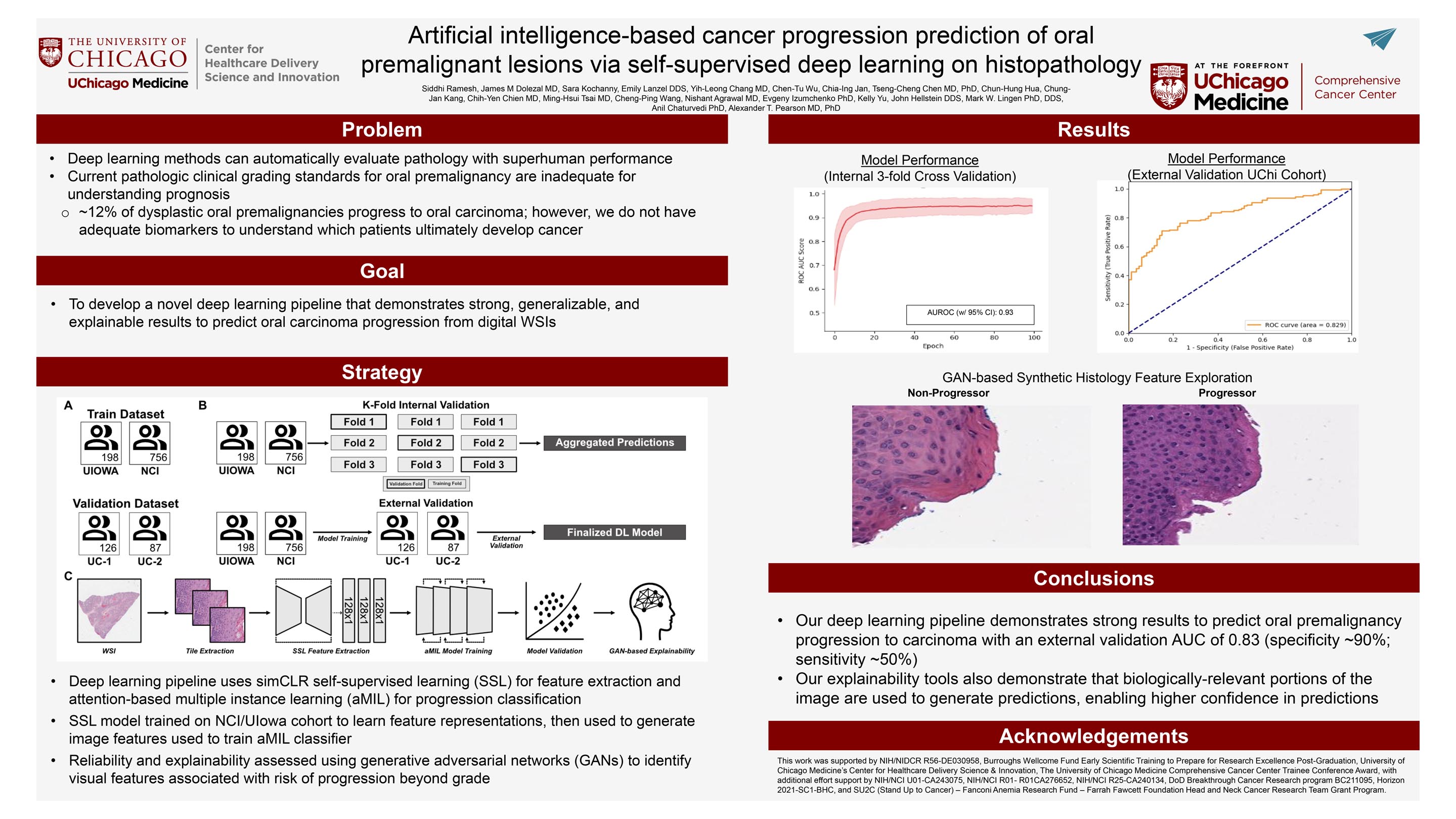 RAMESH_Artificial intelligence-based cancer progression prediction of oral premalignant lesions via self-supervised deep learning on histopathol